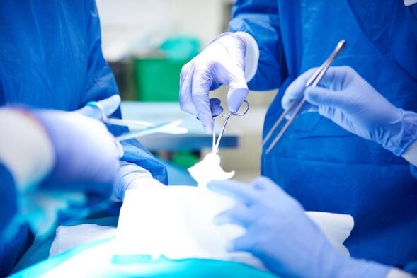 Χειρουργική επέμβαση για μεγέθυνση του ανδρικού γεννητικού οργάνου